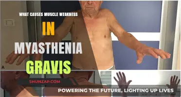 Understanding Myasthenia Gravis: Unraveling the Causes of Muscle Weakness