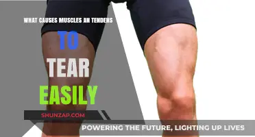 Understanding Easy Muscle and Tendon Tears: Causes and Prevention Tips