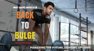 Why Muscles in Your Back Bulge: Causes and Solutions Explained