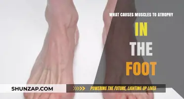 Understanding Foot Muscle Atrophy: Causes and Contributing Factors Explained
