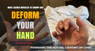 Hand Cramps and Deformity: Unraveling the Causes of Muscle Spasms