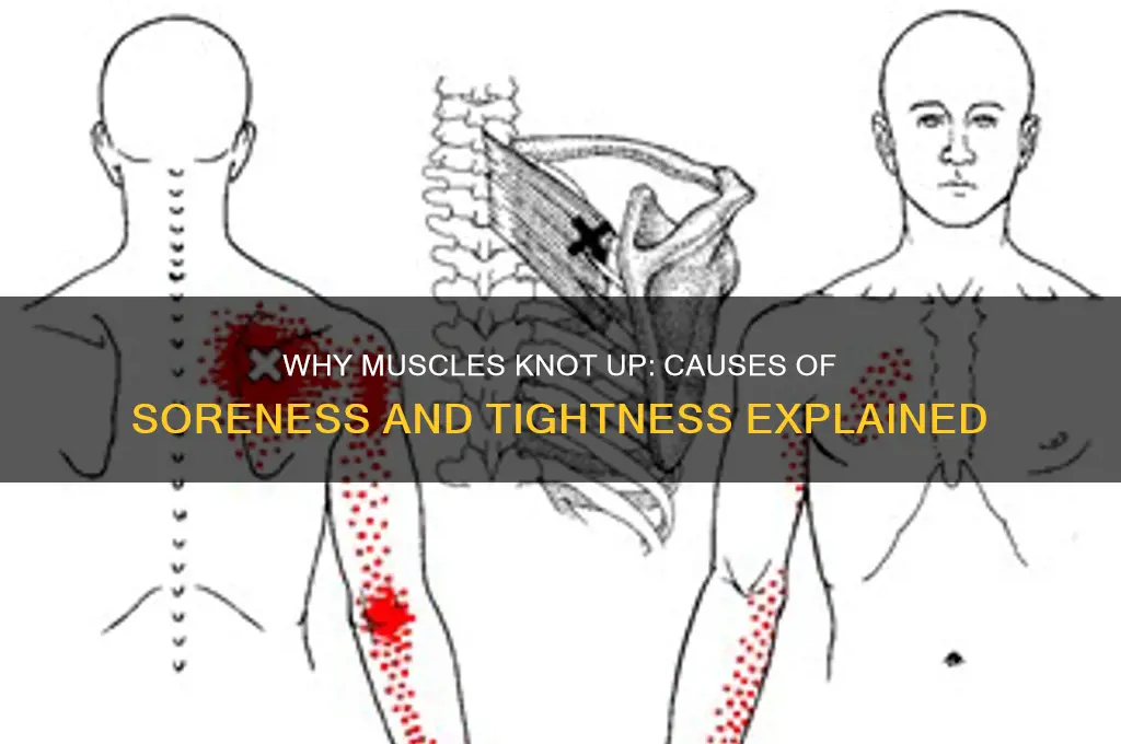 what causes muscles to knot up or be sore