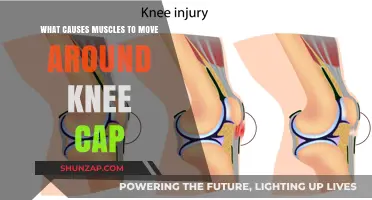 Understanding Knee Cap Muscle Movement: Causes and Mechanisms Explained