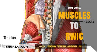 Understanding Muscle RWIC: Causes, Prevention, and Effective Treatment Strategies