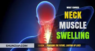Understanding Neck Muscle Swelling: Causes, Symptoms, and Effective Remedies