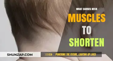 Understanding Neck Muscle Shortening: Causes and Prevention Strategies