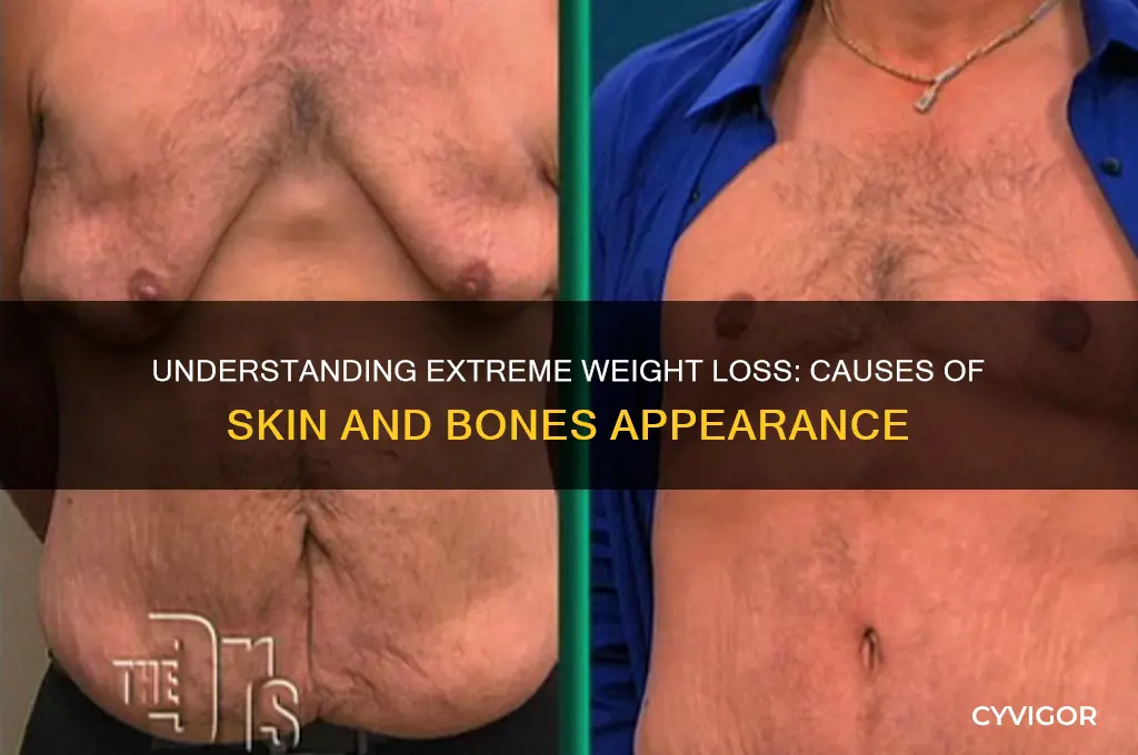 what causes no muscle just skin and bones