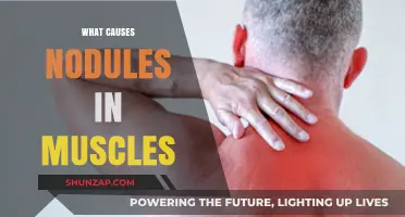 Understanding Muscle Nodules: Causes and Contributing Factors Explained