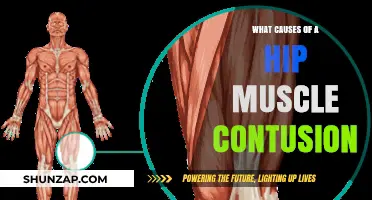 Understanding Hip Muscle Contusions: Causes, Symptoms, and Prevention Tips