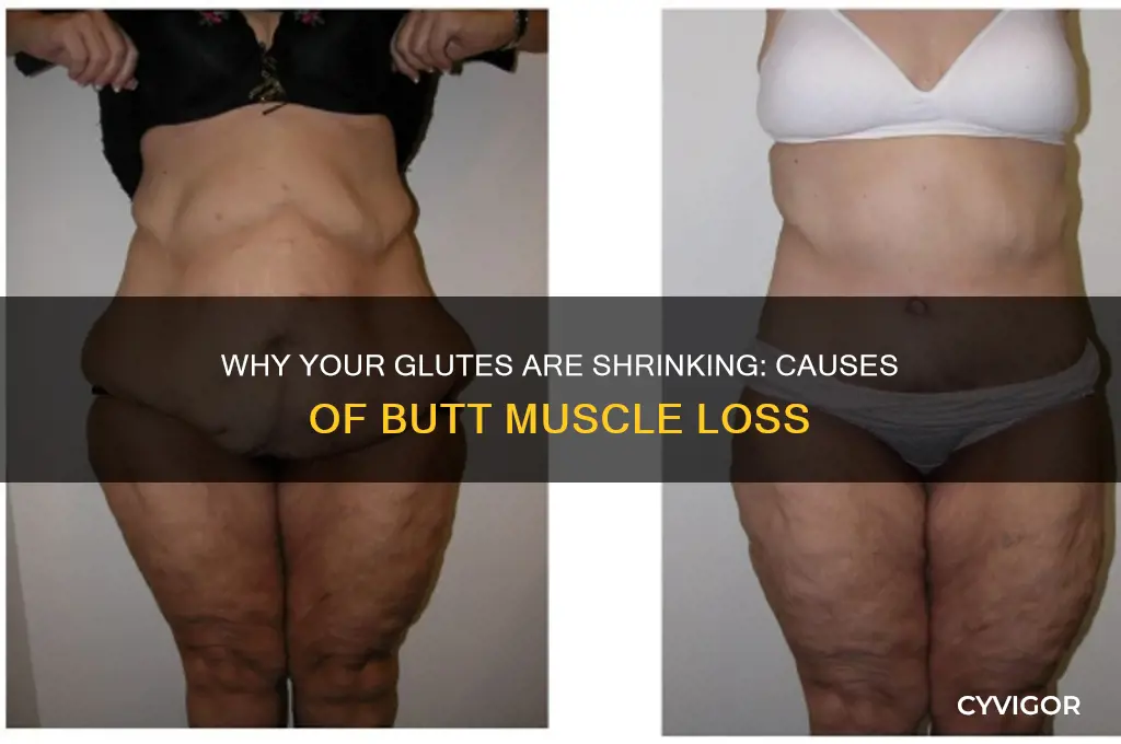 what causes one to loose their butt muscle