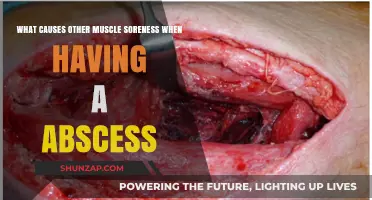 Abscess-Related Muscle Soreness: Causes and Underlying Mechanisms Explained