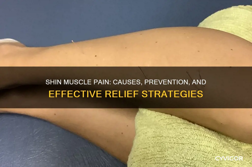 what causes pain in shin muscle