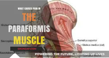 Understanding Paraformis Muscle Pain: Causes and Triggers Explained