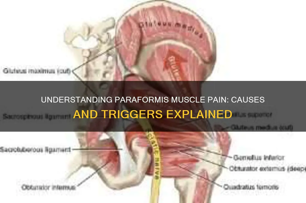 what causes pain in the paraformis muscle
