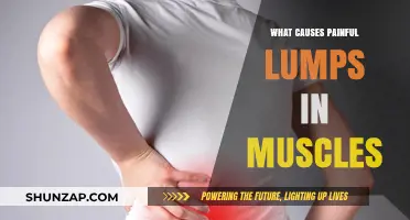 Understanding Painful Muscle Lumps: Causes, Symptoms, and Treatment Options