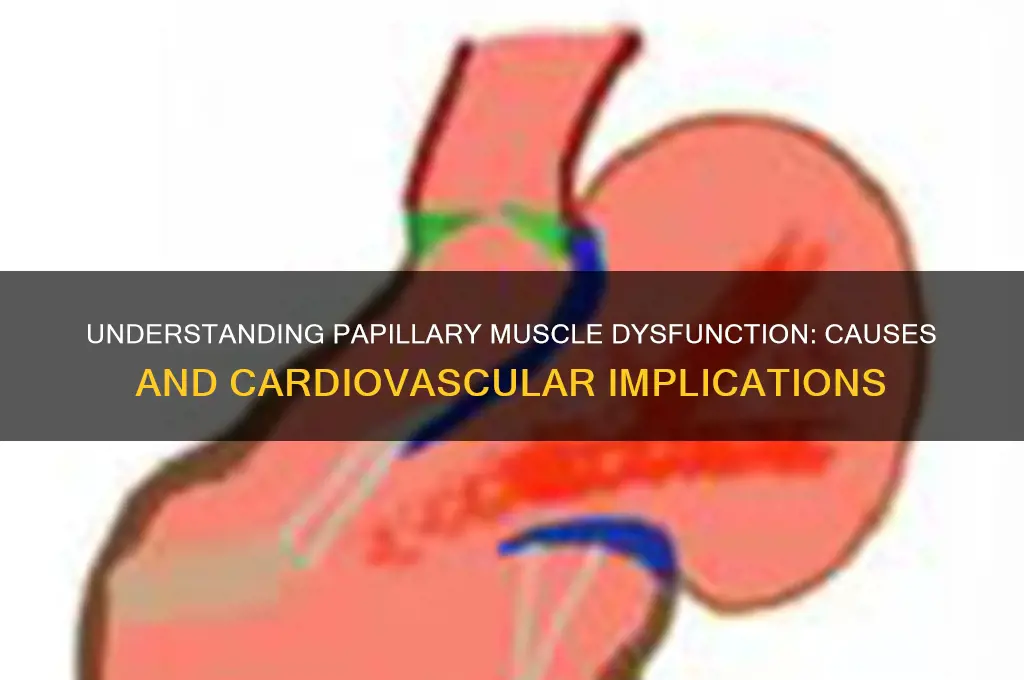 what causes papillary muscle dysfunction