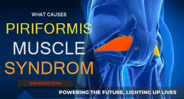Piriformis Syndrome: Understanding the Root Cause