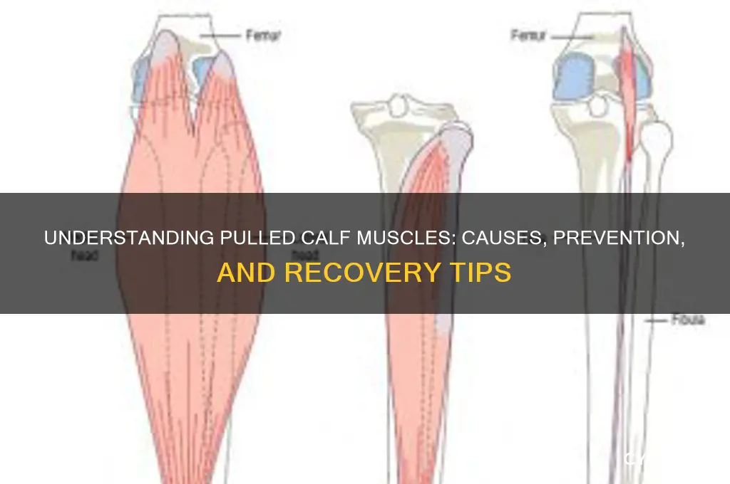 what causes pulled calf muscles