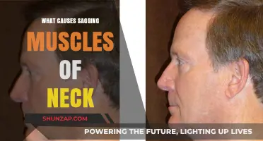 Understanding Sagging Neck Muscles: Causes and Prevention Tips