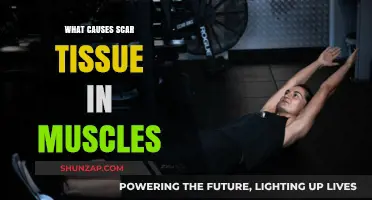Understanding Muscle Scar Tissue: Causes, Prevention, and Effective Treatment Strategies