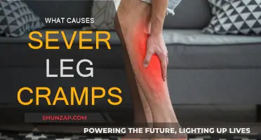 Leg Cramps: Causes and Triggers