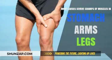 Understanding Severe Muscle Cramps: Causes in Stomach, Arms, and Legs