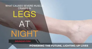 Night Leg Cramps: Causes and Prevention