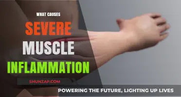 Unraveling Severe Muscle Inflammation: Causes, Triggers, and Underlying Factors
