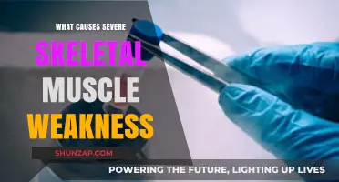 Understanding Severe Skeletal Muscle Weakness: Causes and Contributing Factors