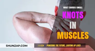 Understanding Small Knots in Muscles: Causes and Prevention Tips
