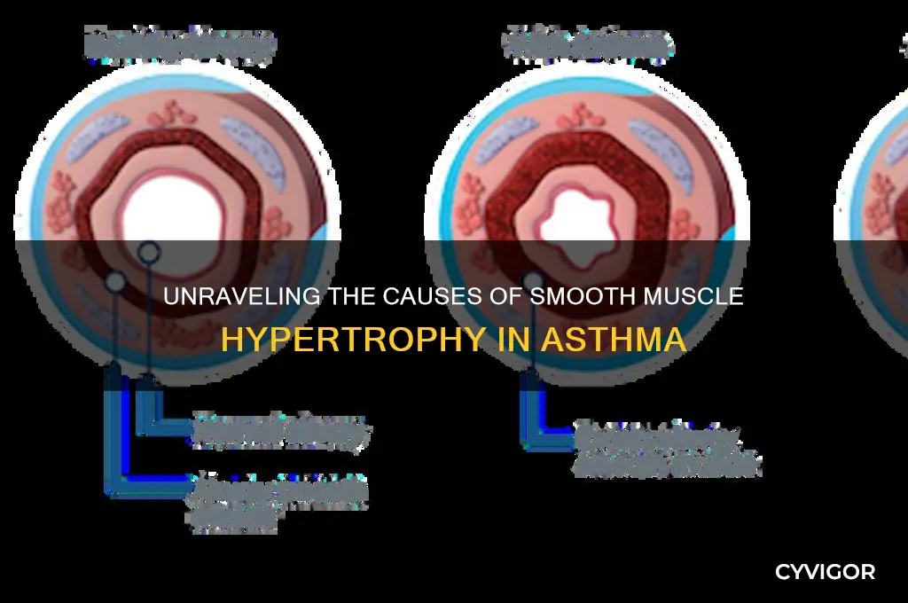what causes smooth muscle hypertrophy in ashtma