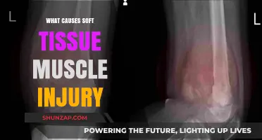 Understanding Soft Tissue Muscle Injuries: Causes and Prevention Tips