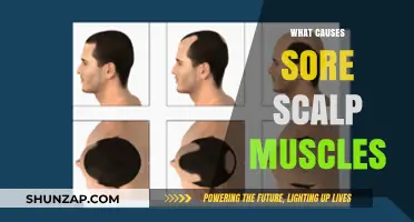 Understanding Sore Scalp Muscles: Causes, Triggers, and Relief Strategies