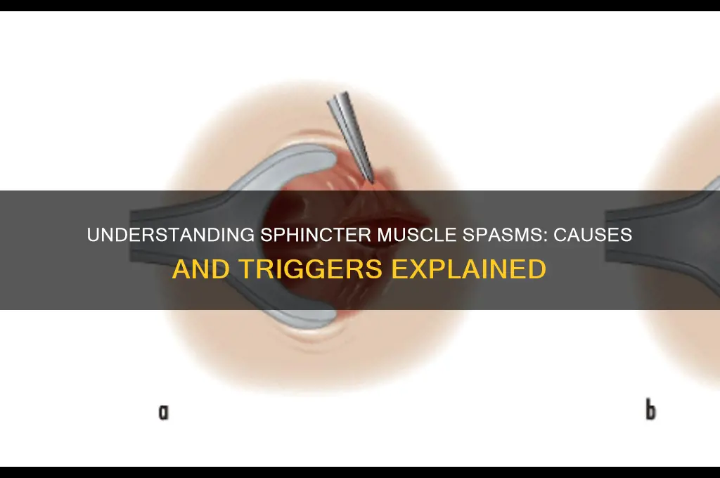 what causes sphincter muscle spasms
