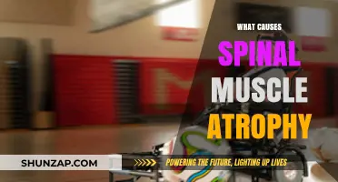 Understanding Spinal Muscle Atrophy: Causes, Genetics, and Early Detection