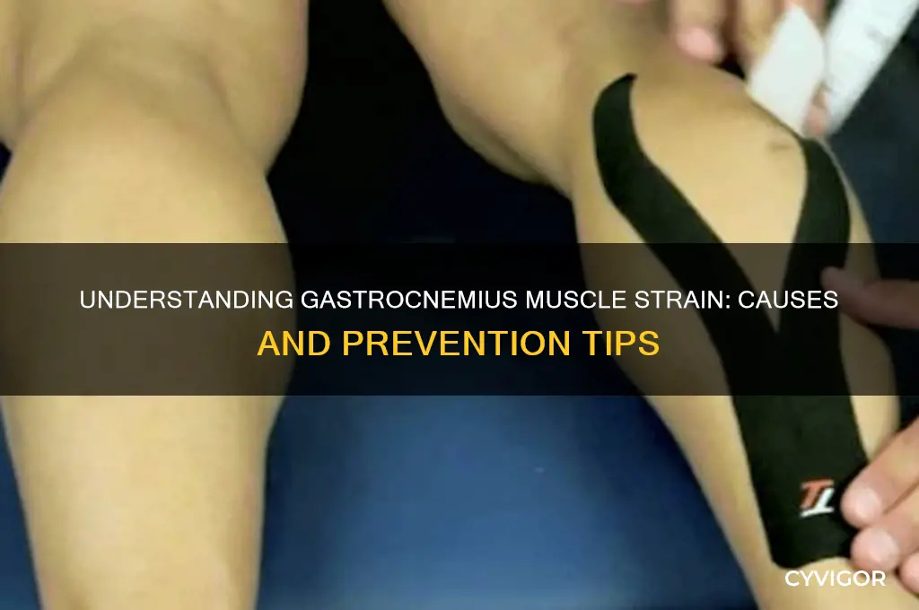 what causes strain of the gastrocnemius muscle