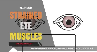 Understanding Strained Eye Muscles: Common Causes and Prevention Tips