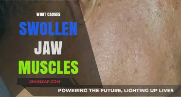 Understanding Swollen Jaw Muscles: Common Causes and Effective Remedies