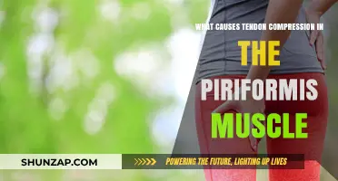Understanding Tendon Compression in the Piriformis Muscle: Causes and Factors