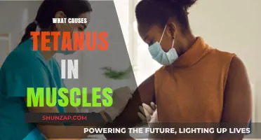 Understanding Tetanus: Causes of Muscle Stiffness and Spasms Explained