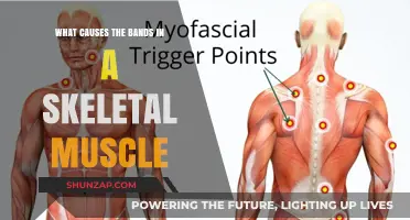 Unveiling the Science Behind Skeletal Muscle Bands: Causes Explained