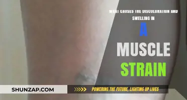 Understanding Muscle Strain: Causes of Discoloration and Swelling Explained
