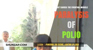 Unraveling Polio's Grip: Understanding the Path to Muscle Paralysis