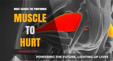 Why Your Piriformis Muscle Hurts: Causes and Triggers Explained