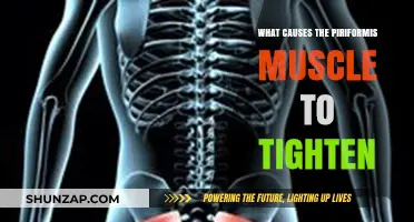 Understanding Piriformis Tightness: Causes and Contributing Factors Explained