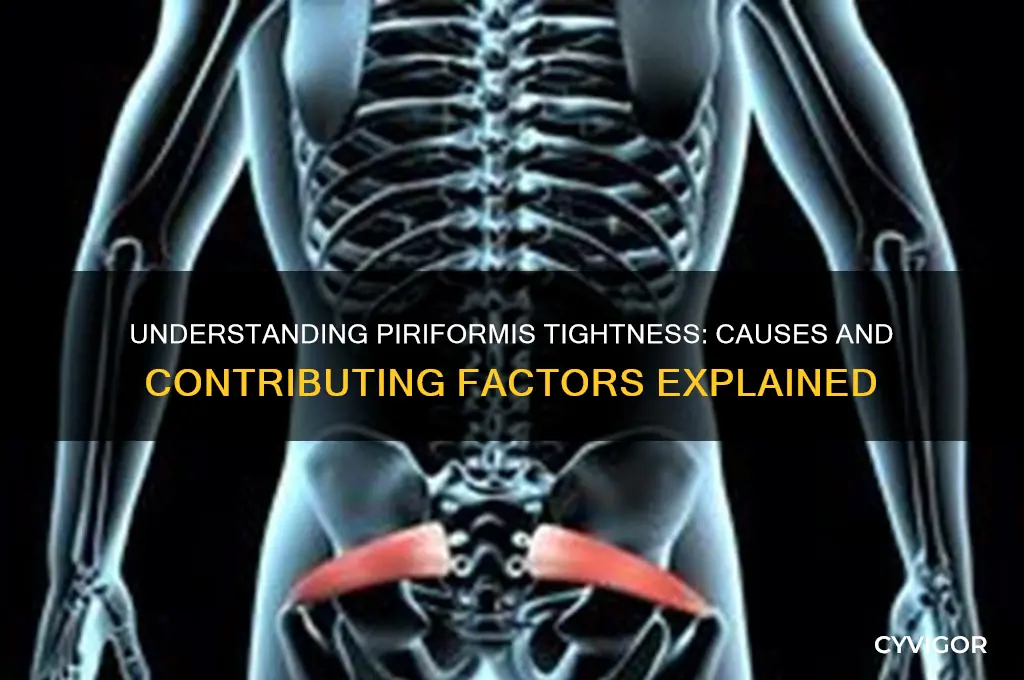 what causes the piriformis muscle to tighten