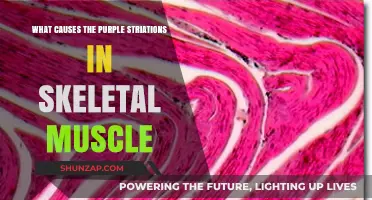 Unveiling the Mystery: What Causes Purple Striations in Skeletal Muscle?