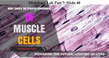 Unraveling the Striated Mystery: What Causes Muscle Cell Patterns?