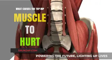 Why Your Top Hip Muscle Hurts: Common Causes and Solutions