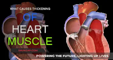Heart Muscle Thickening: Causes and Triggers